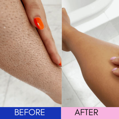 Home Laser Hair Remover Smooth Skin HEYMEEE